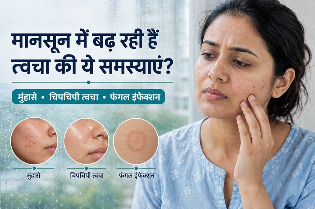 मानसून में मुंहासे, चिपचिपी त्वचा और फंगल इंफेक्शन से परेशान महिला