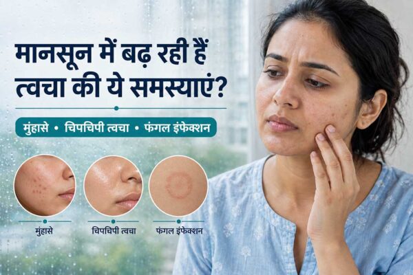 मानसून में मुंहासे, चिपचिपी त्वचा और फंगल इंफेक्शन से परेशान महिला